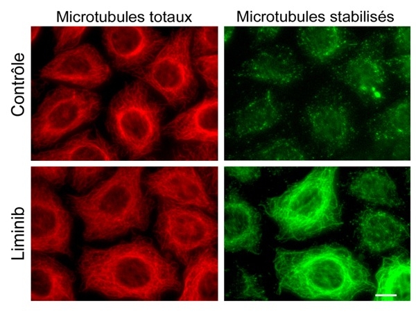 Effet de Liminib sur les cellules cancéreuses. On observe de nombreux microtubules stabilisés en vert dans les cellules traitées par Liminib, ce qui l'empèche de bouger - © Lafanechère/CNRS