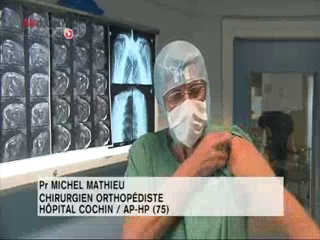 Attention, images de chirurgie ! L'acromioplastie permet de soulager les tendons de l'épaule