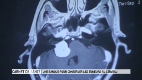 Visite de la tumorothèque de l'Institut du cerveau et de la moelle épinière