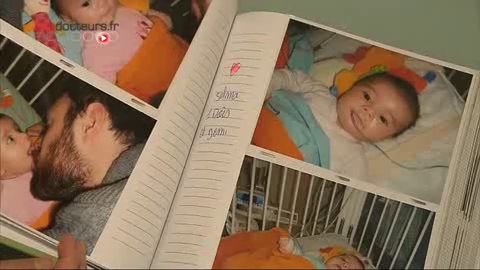 Le risque de péritonite a justifié l'opération de Selma, un mois et demi après sa naissance.
