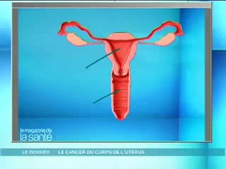 Les explications anatomiques de M. Carrère d’Encausse et M. Cymes (27 mars 2009)