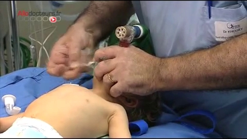 Attention images de chirurgie ! Le chirurgien utilise l'index pour recréer un pouce.