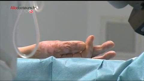 Attention images de chirurgie ! Le déroulement d'une greffe de peau