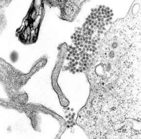 Le virus de la dengue au microscope électronique (CDC)