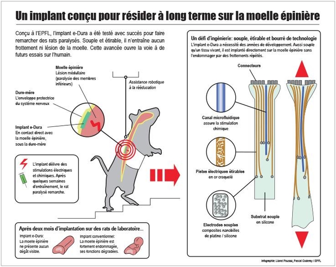 Infographie présentant les propriétés de l'implant e-Dura. (cliquer pour agrandir) Crédits : École polytechnique fédérale de Lausanne.