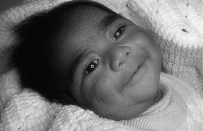 La première greffe du cœur réussie sur un nouveau-né a été réalisée en 1985. L'enfant avait 4 jours. Ci-dessus : Eddie Anguiano, le receveur, quelques semaines après l'opération. Il est toujours en vie à l'heure actuelle. (DR)