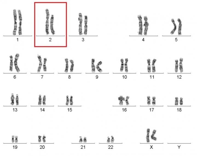 Le caryotype des globules blancs de la patiente (le caryotype désigne l'arrangement standard des chromosomes d'une cellule) - image : NIAID