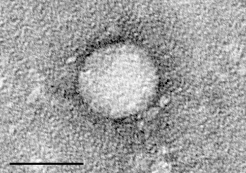 La particule identifiée comme étant le HCV par une équipe nord-américaine en 2013.