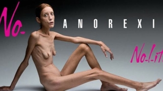 Mort d'Isabelle Caro, ex-mannequin anorexique engagée