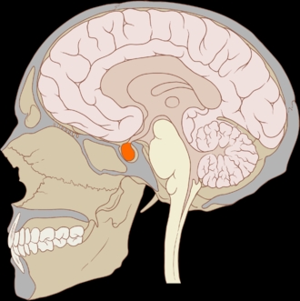 Localisation de l'hypophyse dans le cerveau (en orange). (Illustration : P.J. Lynch cc-by-sa)