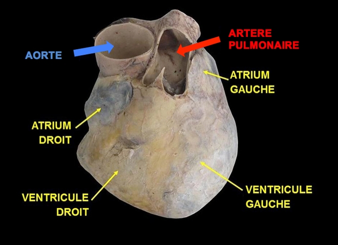 Anatomie d'un coeur, mettant en avant l'artère aorte et l'artère pulmonaire. (cc-by-sa Anatomist90 & Allodocteurs.fr)