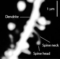 Photographie d'épines dendritiques d'un neurone. Lorsqu'elles touchent les neurones voisins, elles forment avec eux des connexions.