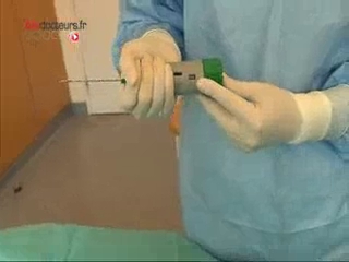 Diagnostic du rejet et observation des différents types de rejet.