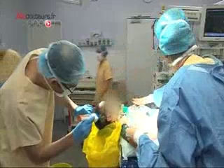 Attention, images de chirurgie : le chirurgien recrée des espaces entre les os du crâne du bébé.