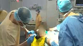 Attention, images de chirurgie : le chirurgien recrée des espaces entre les os du crâne du bébé.