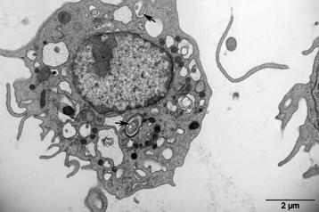 Un macrophage humain infecté par des bactéries Mycobacterium tuberculosis (flèches). (© Eric Ghigo et Sophie Pagnotta / CNRS)