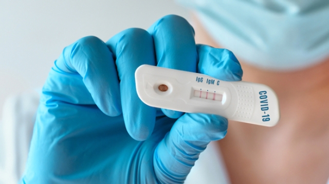 Covid : bientôt un test sérologique avant la vaccination