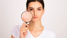 Peau grasse : quelles solutions ?