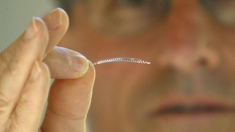 Implants Essure : des premiers effets secondaires aux premières plaintes au pénal, retour sur toute l'affaire