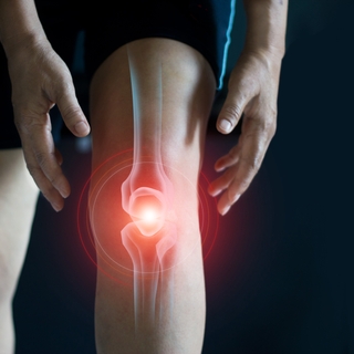 Arthrose du genou : l'ordonnance sportive