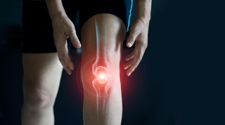 Arthrose du genou : l'ordonnance sportive