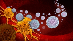 Lymphome : comment l’immunothérapie sauve aujourd'hui les enfants malades