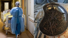 Un kilo de clous et de vis retrouvé dans l’estomac d’un patient lituanien