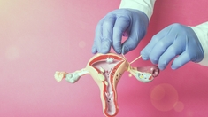 Ligature des trompes : les coulisses de cette contraception définitive