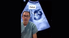 Grossesse extra-utérine : quand le foetus se loge... dans le foie