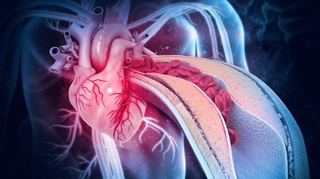 Cholestérol : le score calcique, un examen pour visualiser les artères du coeur