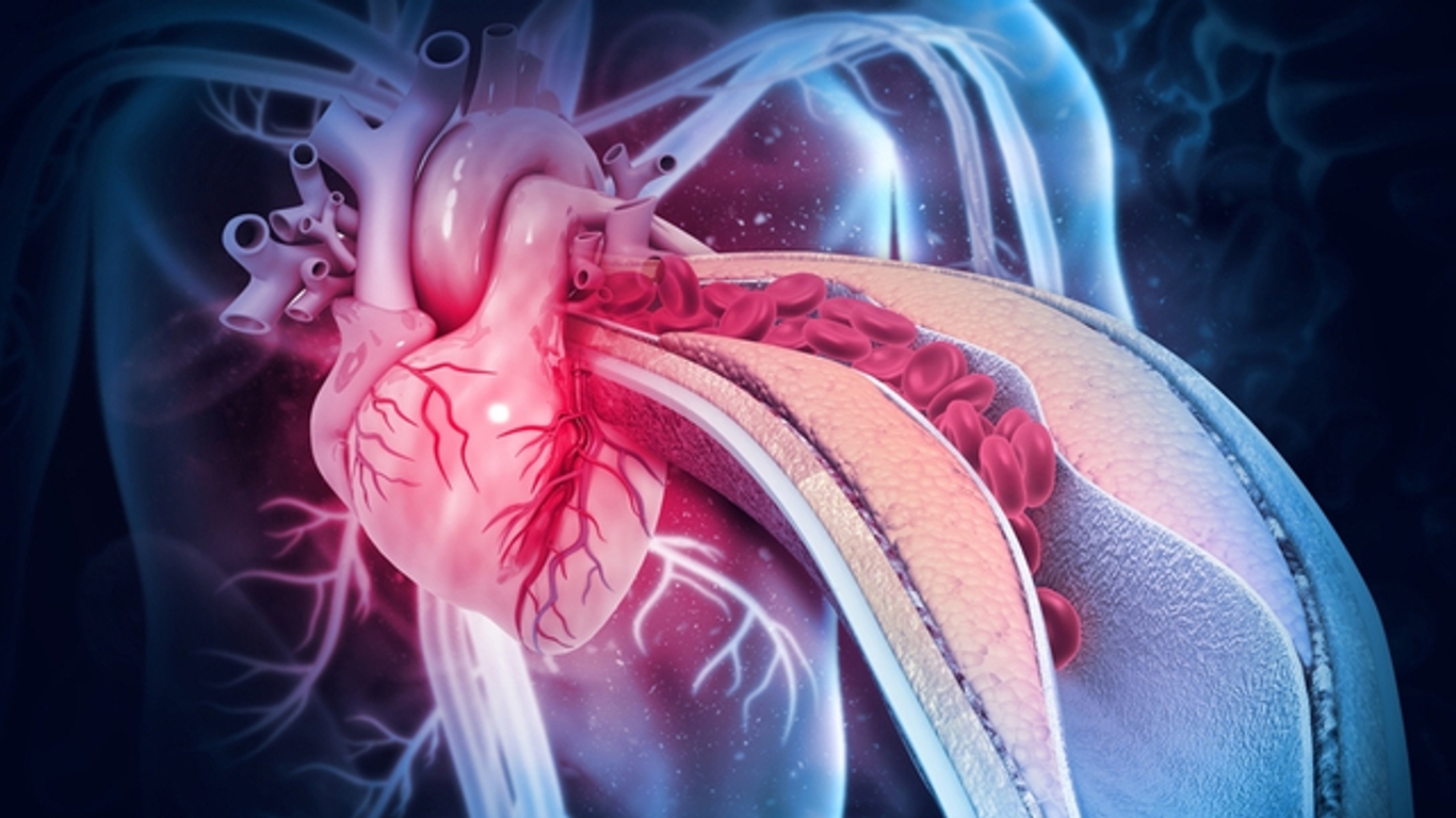Cholestérol le score calcique, un examen pour visualiser les artères du coeur AlloDocteurs