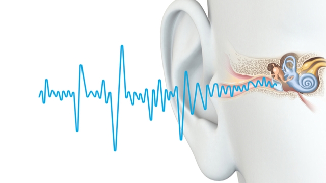 Acouphènes : l'appareillage auditif comme solution