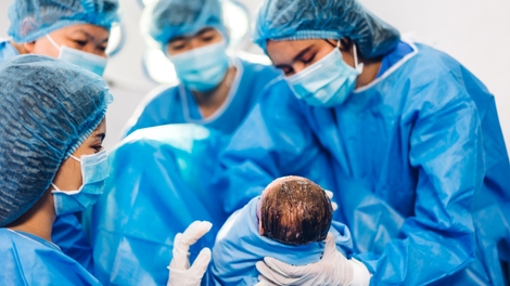 Insolite : un médecin partage la vidéo d’un bébé né "coiffé" de la poche amniotique