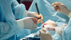 Chirurgie esthétique : quel recours après une opération mammaire ratée ? 