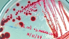 Bactérie E.coli : les autorités sonnent l’alarme après le décès de deux enfants 