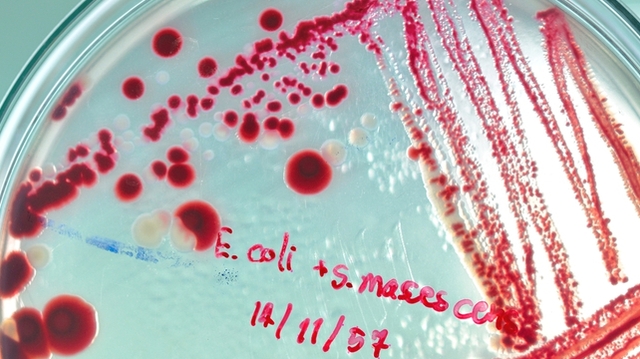 Bactérie E.coli : les autorités sonnent l’alarme après le décès de deux enfants 