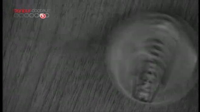 Distilbène : une troisième génération de victimes - Reportage vidéo du 11 avril 2011