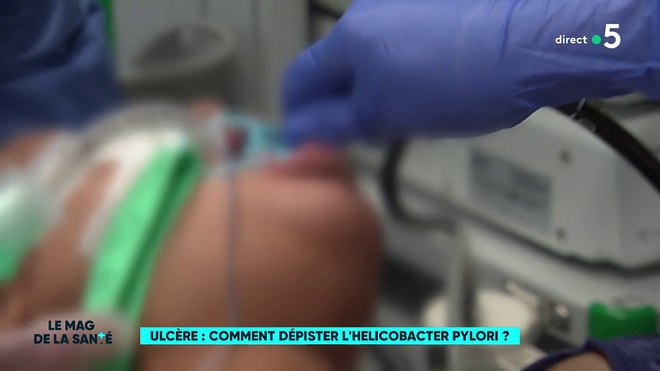 Ulcère : comment dépister l'Helicobacter pylori ?