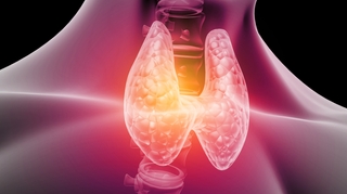 Cancer de la thyroïde : chirurgie, iode et scintigraphie