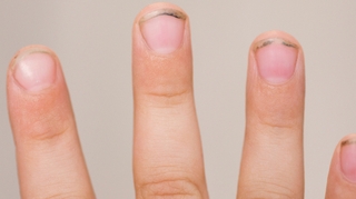 Couper les ongles de mes enfants me rebute : comment faire ?