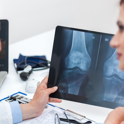 Ostéoporose : préserver le capital osseux