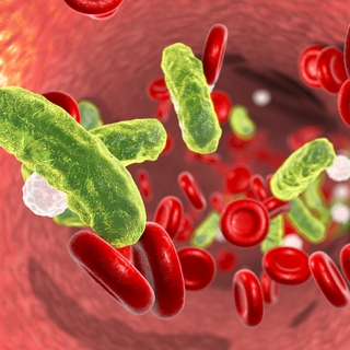 La septicémie ou sepsis : quand les germes envahissent l'organisme