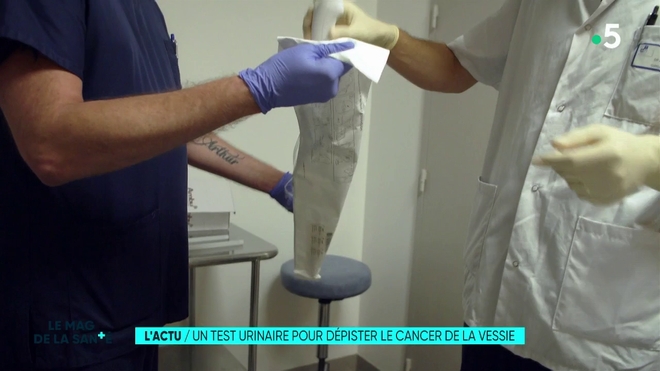 Un test urinaire pour dépister le cancer de la vessie 