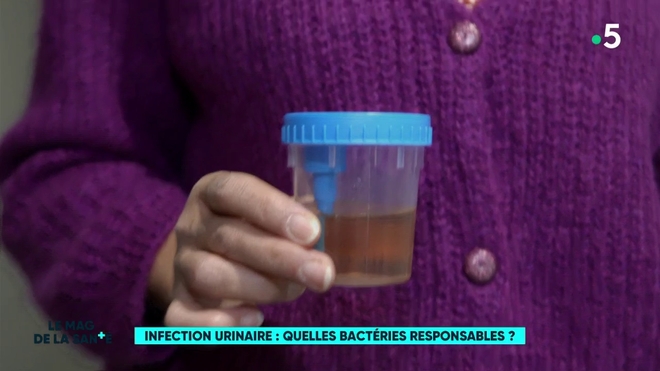 sujet infection urinaire - quelles bactéries responsables ?