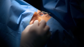Presbytie : comment fonctionne la chirurgie au laser 