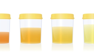 Que révèle la couleur de vos urines ?