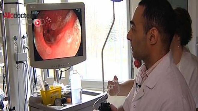 Ulcères digestifs : la fin des idées reçues
