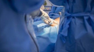 Cholécystectomie : la chirurgie de la vésicule biliaire 