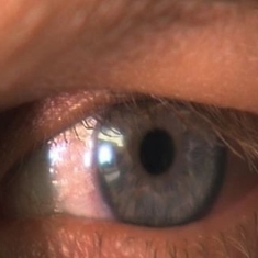 La couleur des yeux et autres secrets de l'iris