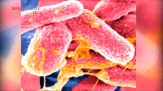 Syndrome hémolytique et urémique lié à la bactérie E. coli qu'est-ce que c'est ?